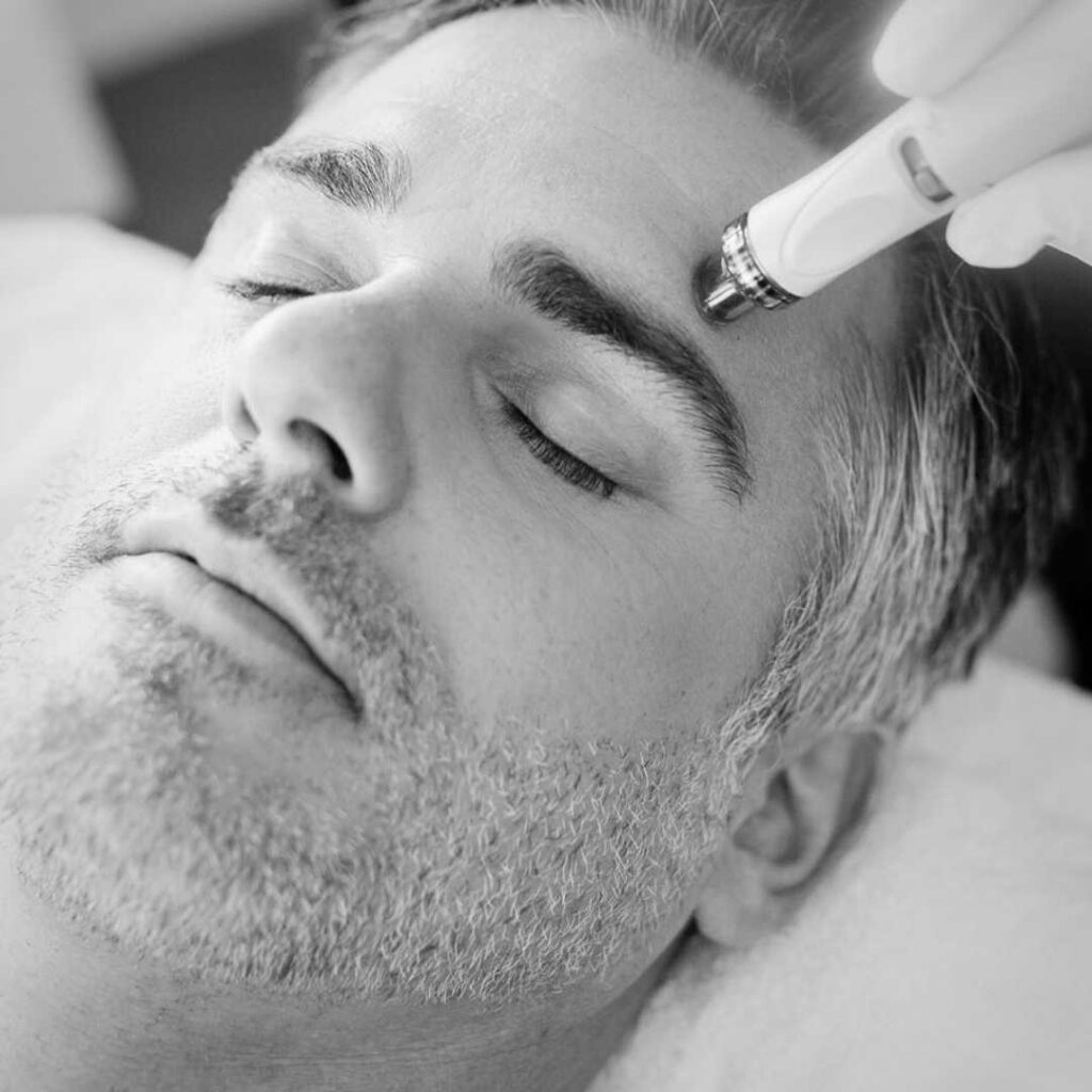 Middle aged Male receiving Hydrofacial/hydrodermabrasion treatment